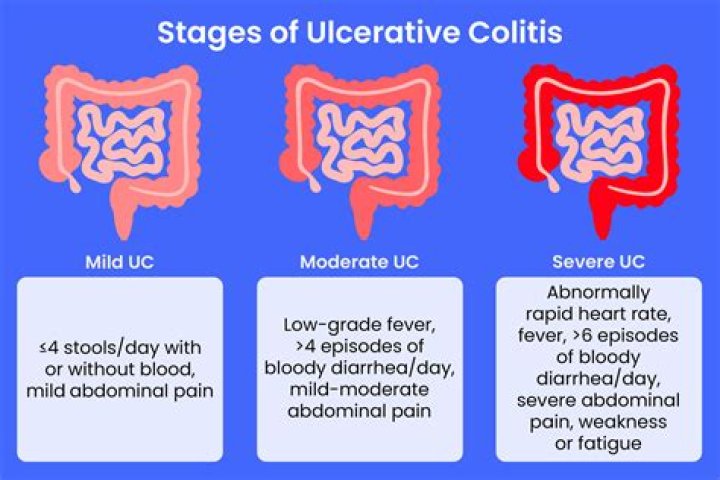 
Does Amy Brenneman have ulcerative colitis? Diseases and health news 