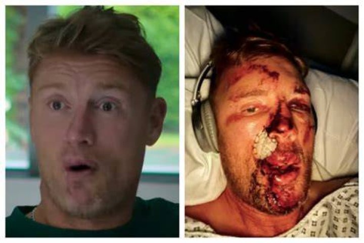 
Does Freddie Flintoff Have An Eating Disorder? Fans Worried About His Health 