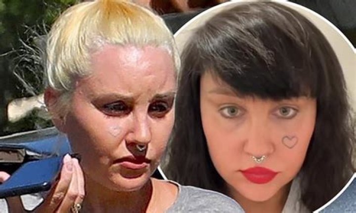 ‘Heart No More’ Amanda Bynes Face Tattoo Removal and Update, Where Is She Now 2022?
