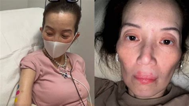 
Kris Aquino Illness And Health Problems -What Happened To Her? 