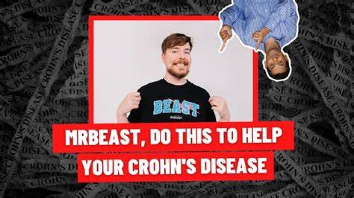 Mr Beast Crohn Disease Led To Death Hoax, Your Favorite YouTuber Is Alive and Well