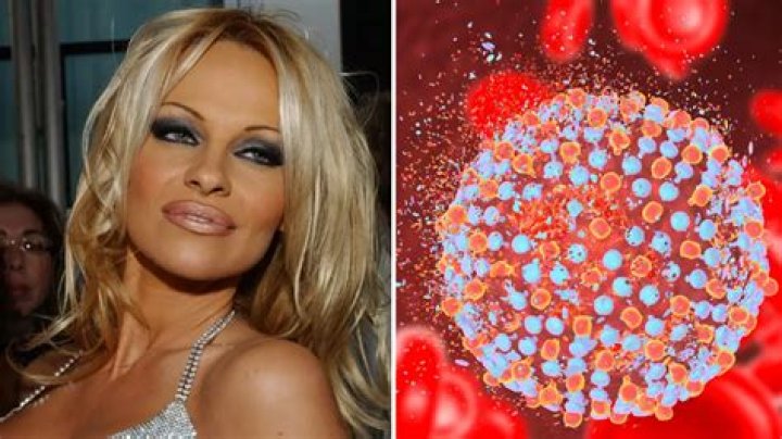 
Pamela Anderson Illness And Health Update: What Happened To Her? 