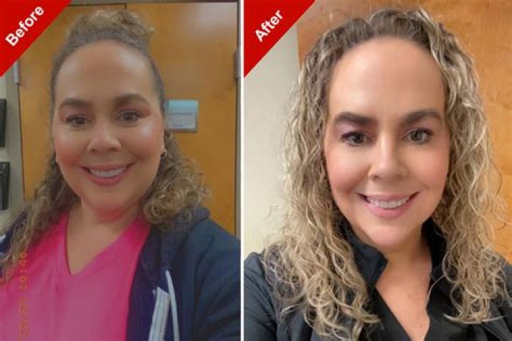 Raven Symone Plastic Surgery | Photos Before And After 18 Years