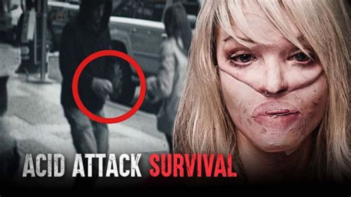 
The Truth About Katie Piper, Her Husband and What Led to Her Acid Attack 